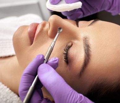Young woman receiving an acne extraction at a medspa.